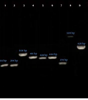 Jundishapur J Microbiol